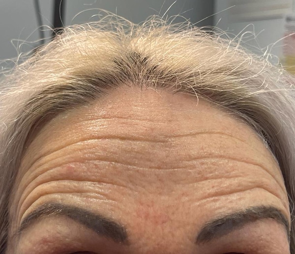 Before-facethree
