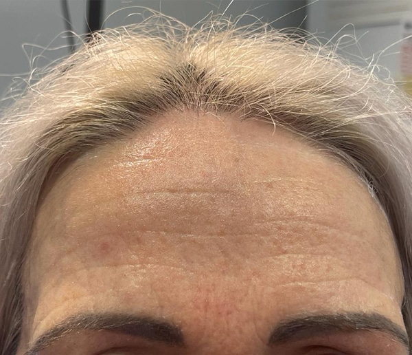 After-facethree