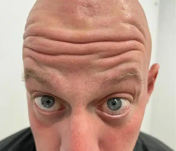 Before-facefive