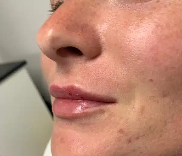 After-facetwo