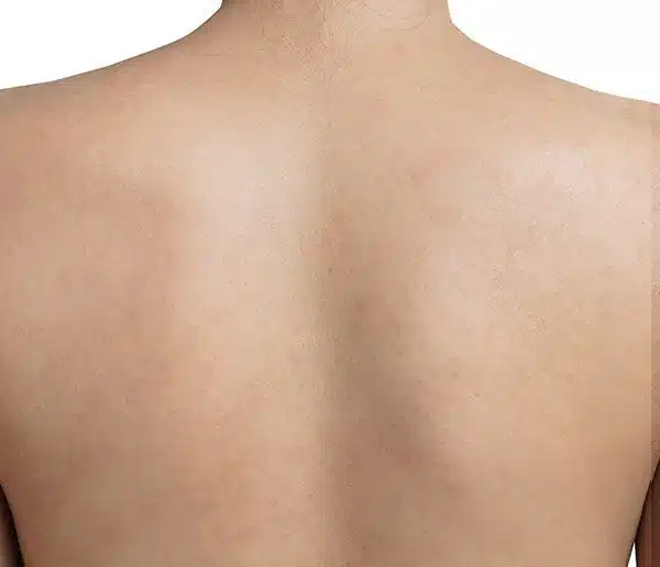After-bodytwo