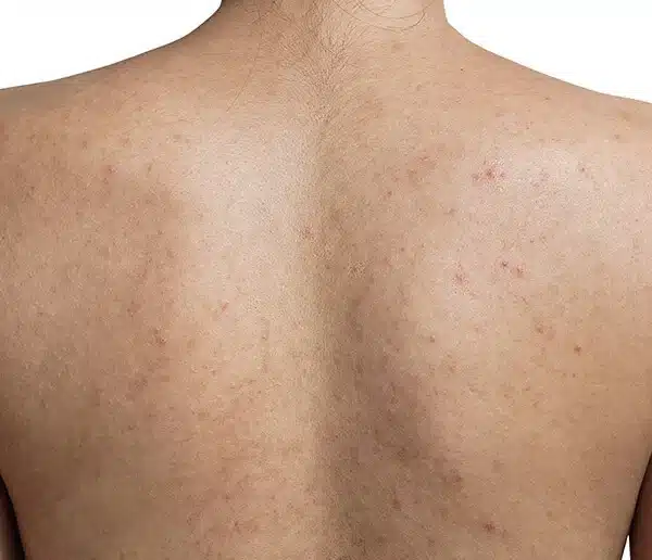 Before-bodytwo