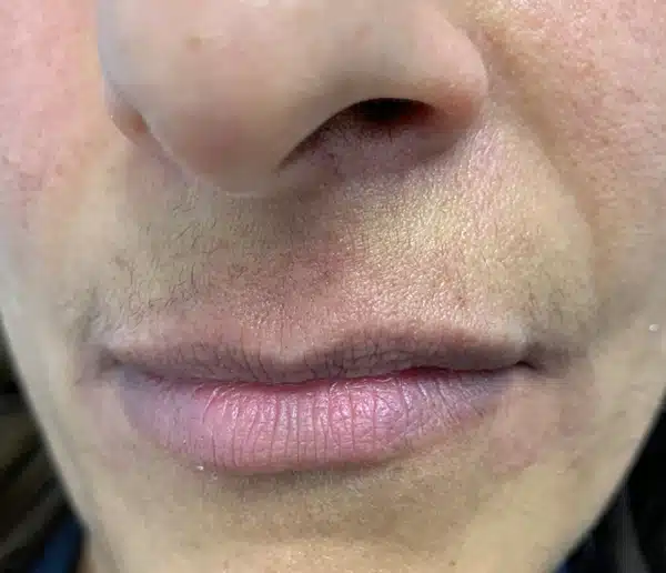 Before-slider1