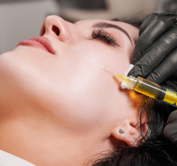 Platelet-Rich-Plasma-(PRP)-f Platelet Rich Plasma PRP f