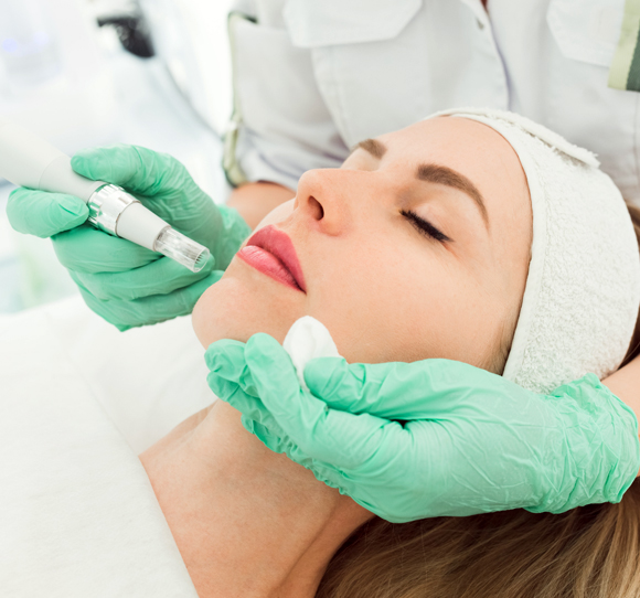 Microneedling Microneedling
